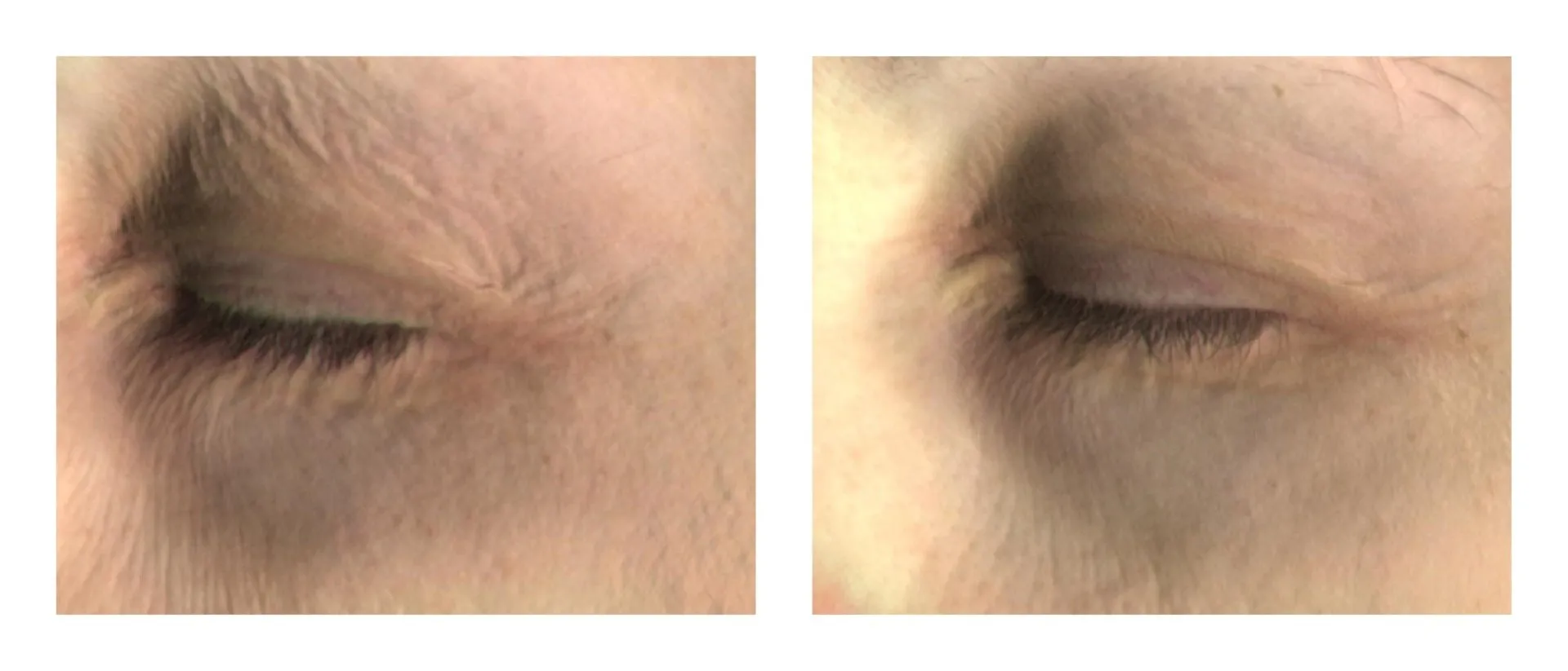 Глаза-07.jpg
