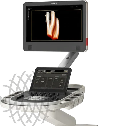 Philips EPIQ CVx ультразвуковой аппарат