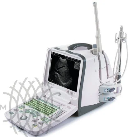 УЗИ аппарат Mindray DP-6900 портативный
