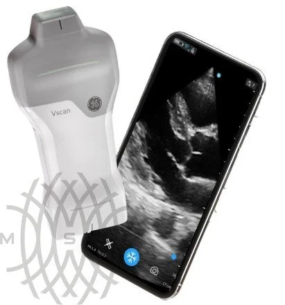 УЗИ аппарат GE HealthCare Vscan Air карманный