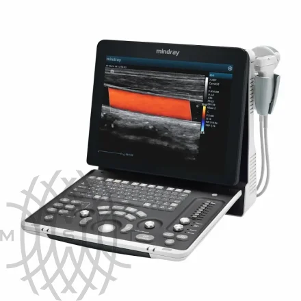 УЗИ аппарат Mindray Z60 Exp портативный