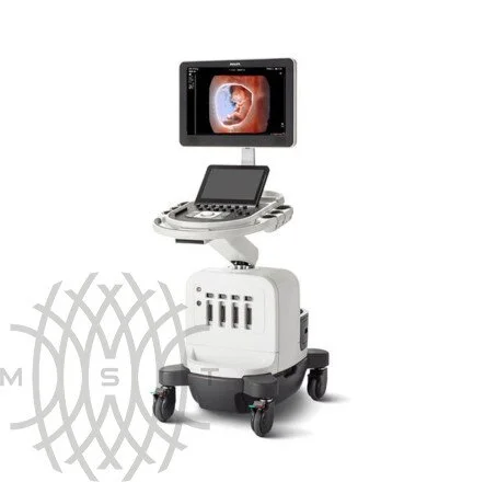 Philips Affiniti 30 ультразвуковой аппарат