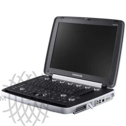 Samsung Medison HM70A УЗИ аппарат портативный