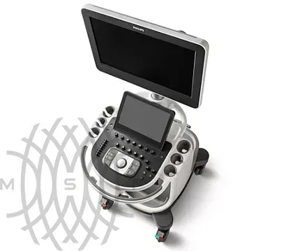 Philips Affiniti 70 ультразвуковой аппарат