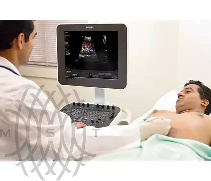 Philips ClearVue 350 ультразвуковой аппарат