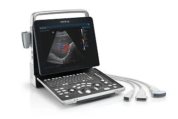 УЗИ аппарат Mindray Z60 портативный