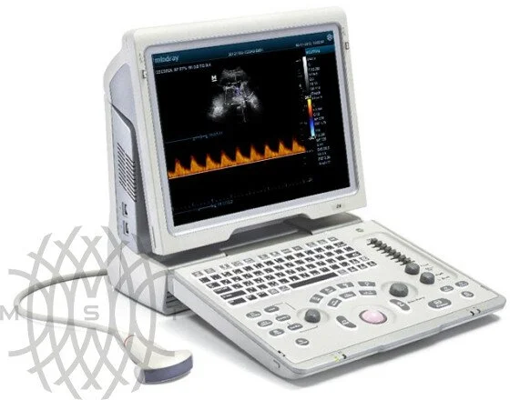 УЗИ аппарат Mindray DP-50 портативный